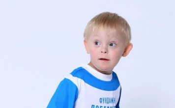 Cómo es vivir con el Síndrome de Down Sindrome de Down 1