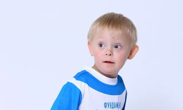 Cómo es vivir con el Síndrome de Down Sindrome de Down 1